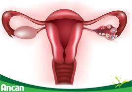 Cách điều trị u nang buồng trứng