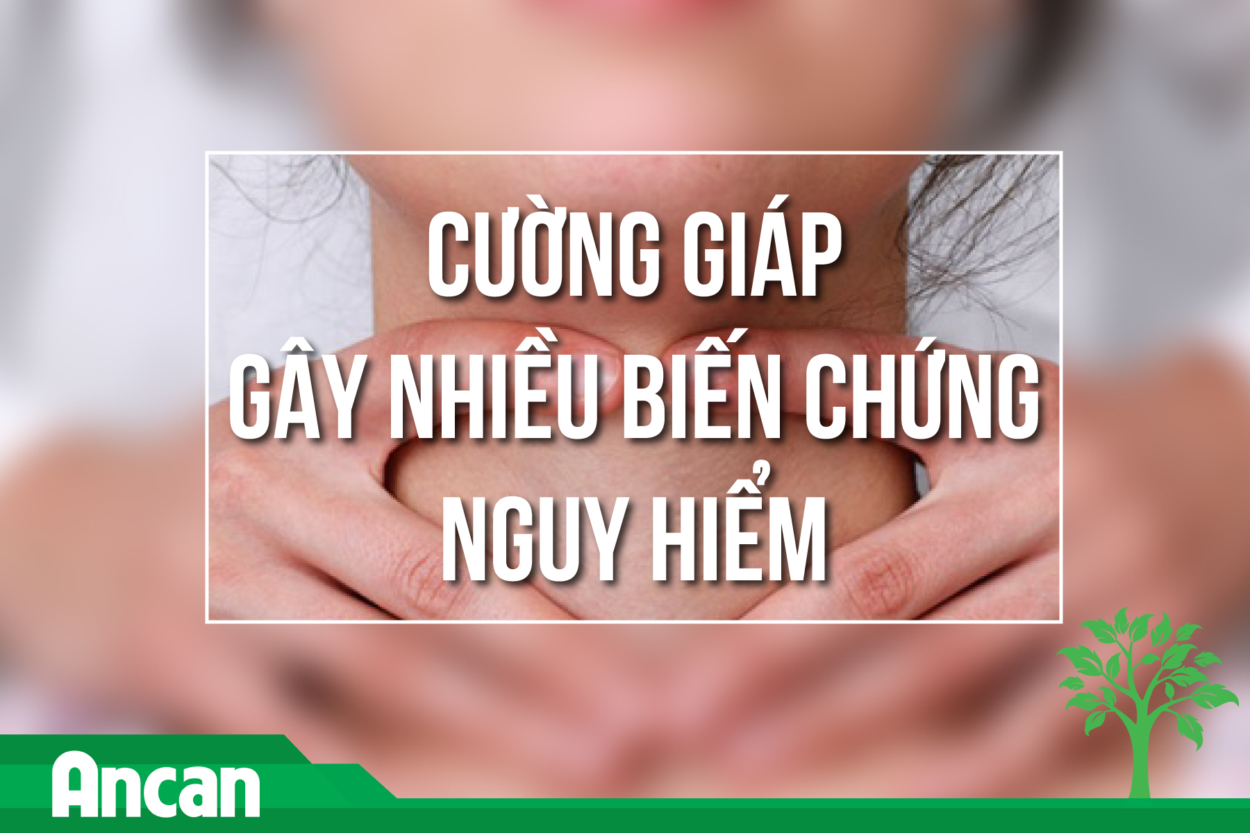 Cường giáp gây nhiều biến chứng nguy hiểm