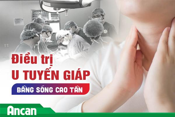 Điều trị u tuyến giáp bằng sóng cao tần