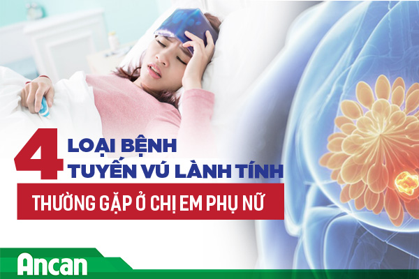 4 loại bệnh tuyến vú lành tính thường gặp ở chị em phụ nữ