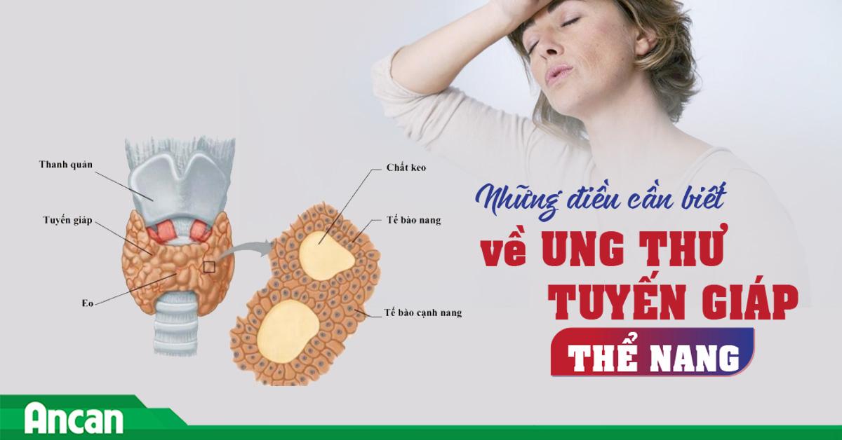 Những điều cần biết về ung thư tuyến giáp thể nang
