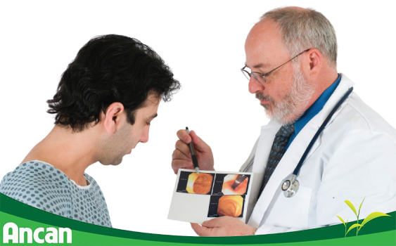 Nam giới dễ mắc ung thư đại trực tràng