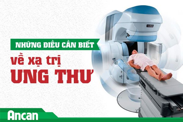 Những điều cần biết về xạ trị ung thư