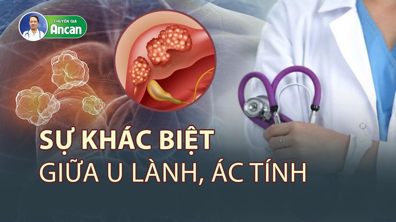 Sự khác biệt giữa u lành tính, ác tính