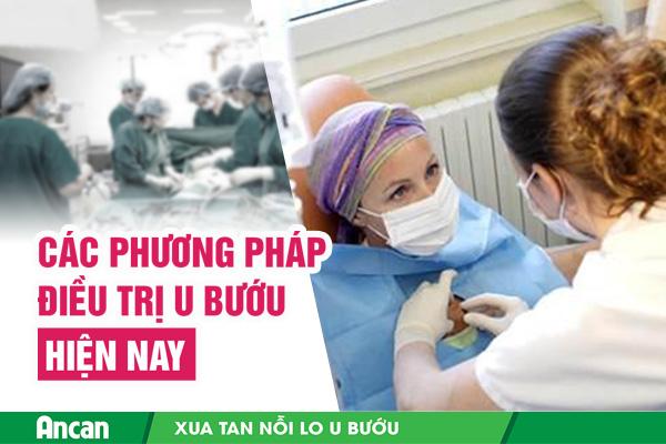 Các phương pháp điều trị u bướu hiện nay