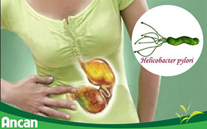 Thủ phạm gây ung thư dạ dày ở 70% người Việt