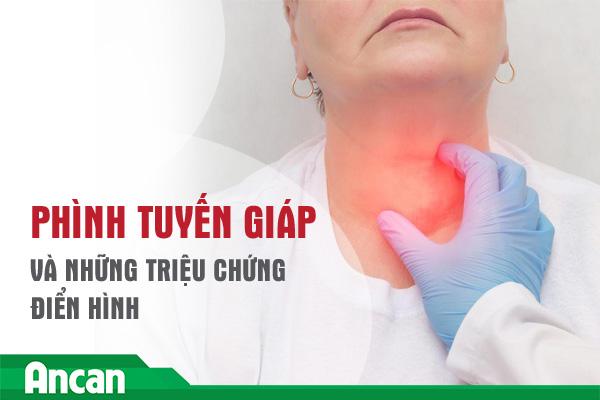 Những triệu chứng của bệnh phình tuyến giáp