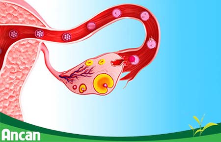 U nang buồng trứng có nguy hiểm không?