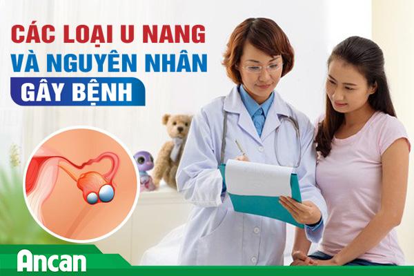 Các loại u nang và nguyên nhân gây bệnh