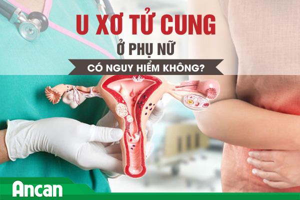 U xơ tử cung có nguy hiểm không?
