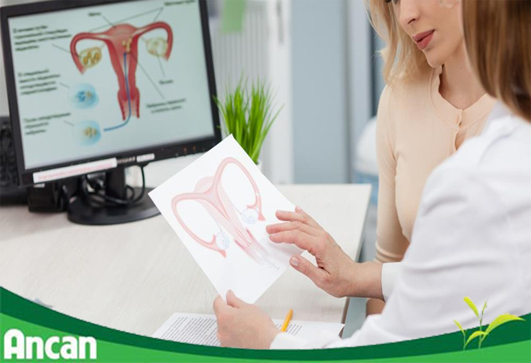 [Giải đáp]: Bệnh u xơ tử cung có nguy hiểm không? có nguy cơ chuyển thành ung thư không?