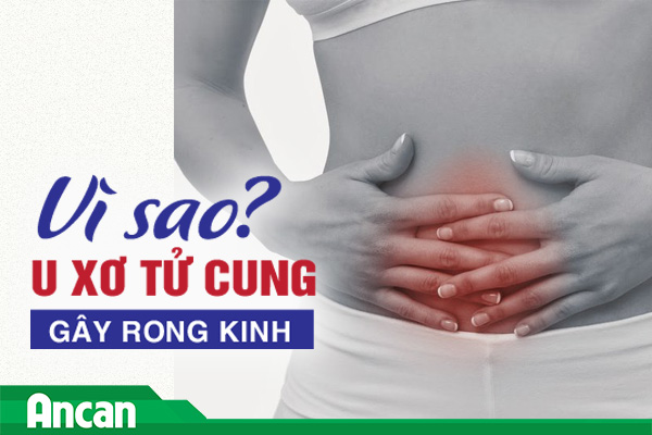 Vì sao u xơ tử cung gây rong kinh?