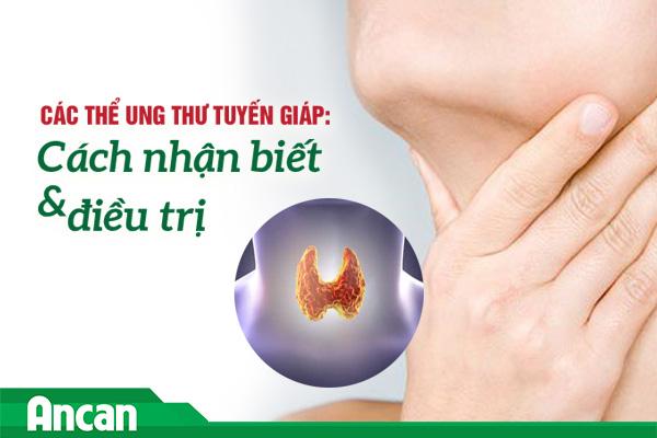 Các thể ung thư tuyến giáp: Cách nhận biết và điều trị